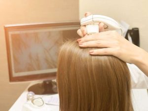Why Silicone Hair Systems Are the Best Choice for Sensitive Scalps